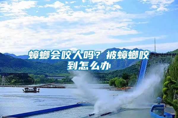 蟑螂會咬人嗎？被蟑螂咬到怎么辦